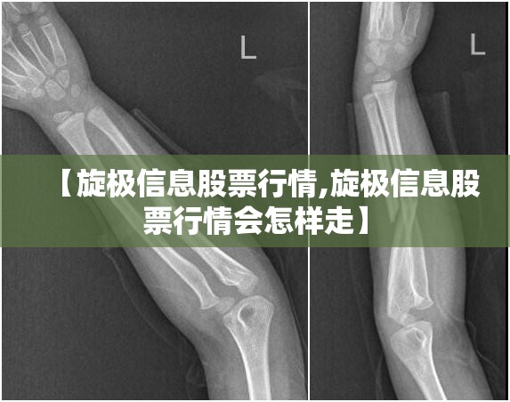 【旋极信息股票行情,旋极信息股票行情会怎样走】