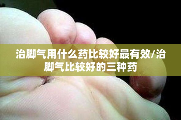 治脚气用什么药比较好最有效/治脚气比较好的三种药